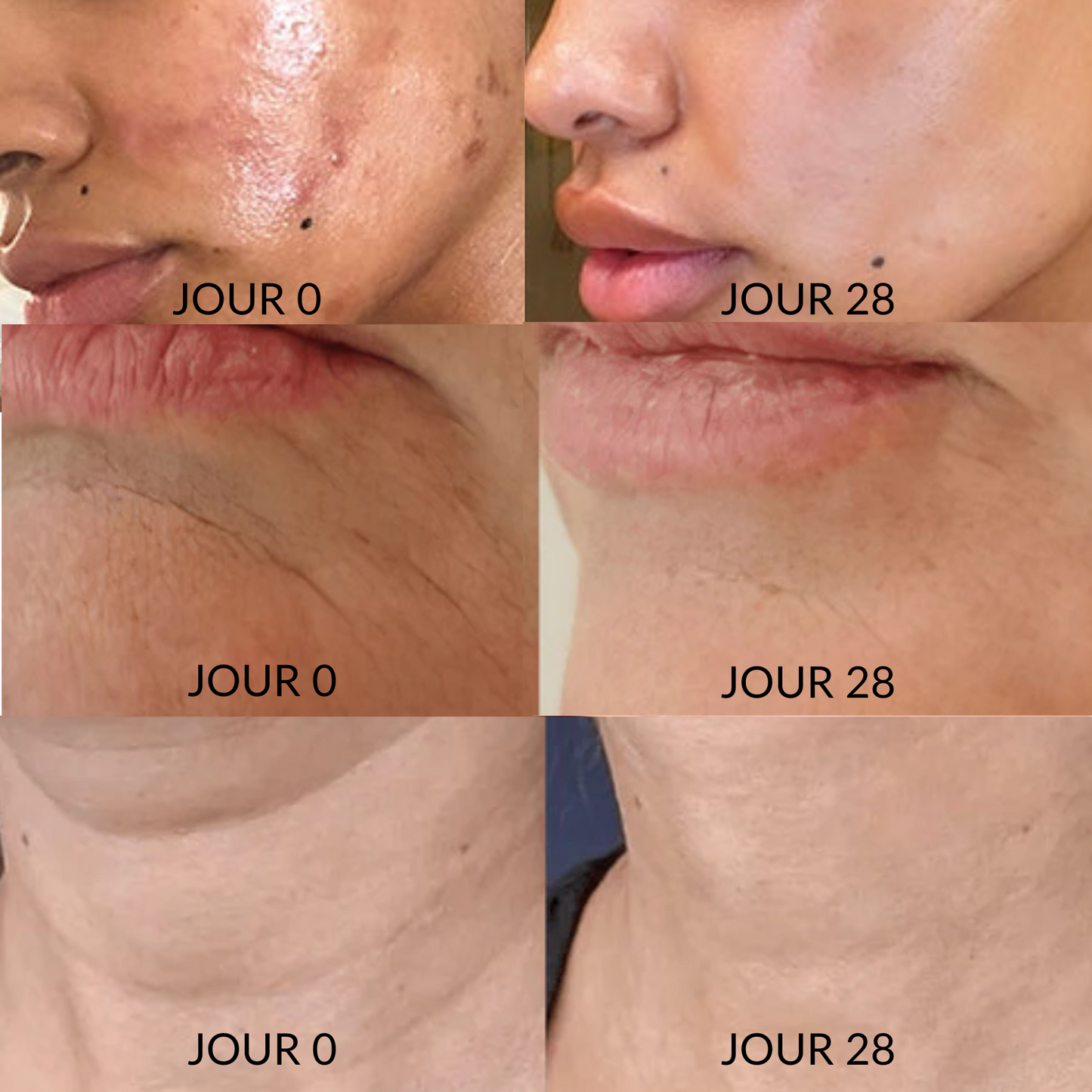 Trésor anti-âge :  Huile pure de pépins de figue de barbarie BIO